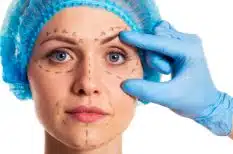 Cirugía de lifting facial