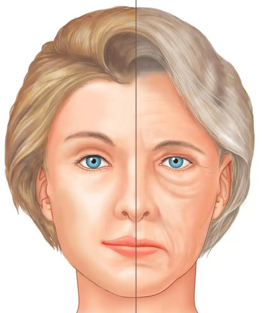 cirugia de lifting facial