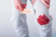 Como quitar manchas de sangre de la ropa