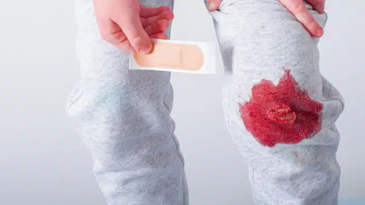 Como quitar manchas de sangre de la ropa