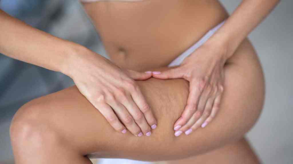 reducir la celulitis