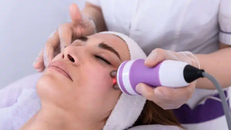 Tratamiento estético de radiofrecuencia facial